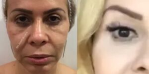 Joelma em antes e depois de procedimento estético - Foto Reprodução Internet