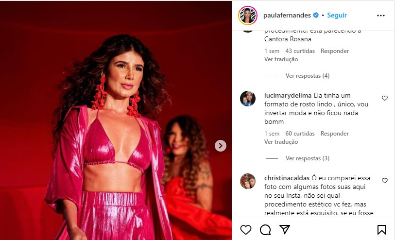 Paula Fernandes fez uma harmonização que não caiu bem (Foto: Reprodução)