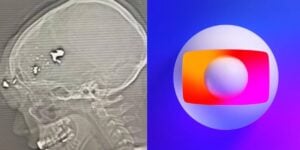 Globo confirma assalto de famoso e estado da saúde é divulgado (Reprodução: Montagem TV Foco)
