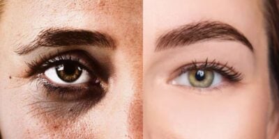 3 misturinhas caseiras que rejuvenescem em até 20 anos - Montagem TVFOCO