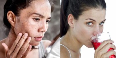 Bebida com 3 ingredientes rejuvenesce a pele de dentro para fora  - Montagem TVFOCO