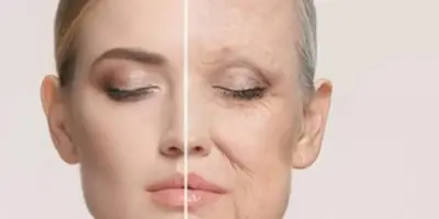 30 anos mais jovem e sem rugas : ‘Botox caseiro’ fará de GRAÇA o que dermatologistas cobram uma fortuna