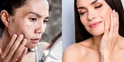Natura e Avon provavelmente não querem que você saiba: Colágeno caseiro rejuvenesce até 20 anos em 7 passos