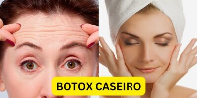 Botox caseiro. Foto: Reprodução/Internet