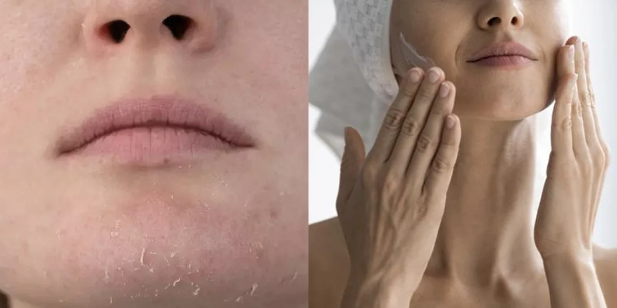 17. Receita milagrosa com apenas 2 ingredientes para rejuvenescer décadas - Foto: Reprodução/Internet