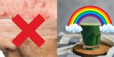 Adeus acne, rugas e manchas: Suco caseiro milagroso com 3 ingredientes limpa a pele de dentro pra fora