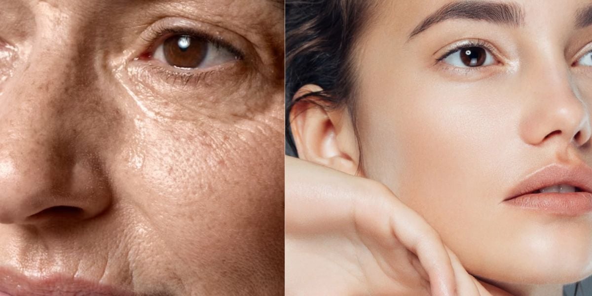 Misturinha caseira com 4 ingredientes traz seu próprio botox natural - Montagem TVFOCO