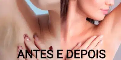 Imagem PreCarregada