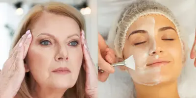 Botox de graça e em casa para dar fim as rugas: Misturinha com 2 ingredientes para voltar aos seus 30 anos