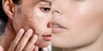 Pele invejável LISINHA e melhor que seda: 3 receitas caseiras para conseguir um resultado espetacular