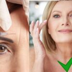 Usando botox, e usando botox caseiro - Foto Reprodução Internet