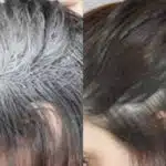 Fim dos cabelos brancos sem precisa usar tinta com química (Foto: Divulgação)
