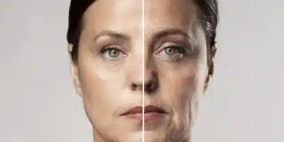 Técnica infalível faz você rejuvenescer e ter lifting natural (Reprodução/Internet)