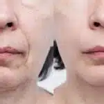 Misturinha com 3 ingredientes dá fim nas rugas em 20 minutos (Reprodução/Montagem TV Foco)
