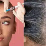 Botox e fios grisalhos (Foto: Reprodução, Montagem - TV Foco)
