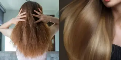 Fim do maior pesadelo do verão: Como ressuscitar o cabelo SECO em 6 passos e sem nenhuma gota de shampoo