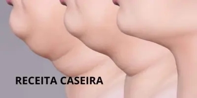 Fim da ODIADA papada com receitinha simples, caseira, sem lipo e em apenas 5 minutinhos na sua casa