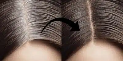 Imagem PreCarregada