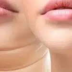 Mulher com papada / Mulher sem papada - Montagem TVFOCO