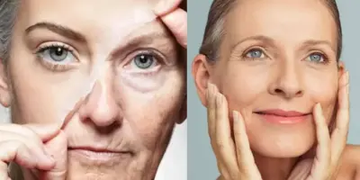 Harmonização facial caseira: Senhoras 70+ fazem festa com segredo que rejuvenesce 10 anos em 10 minutos