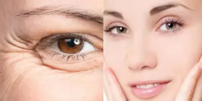Lifiting natural e acaba com rugas e marcas: Máscara milagrosa rejuvenesce o rosto em 25 anos com 2 ingredientes