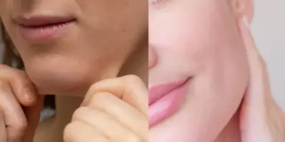 Apenas 2 ingredientes pra acabar com a pele caída: Misturinha 100% caseira deixa sua pele esticada igual botox
