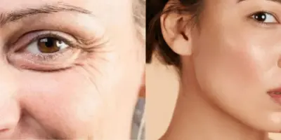 Mais potente que botox: Misturinha com 5 ingredientes traz verdadeira fonte da juventude e fim das rugas