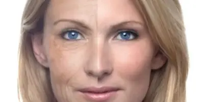 Melhor colágeno do mundo sem nenhum produto: 1 alimento deixa a pele de idosas de 60+ como se tivessem 30