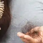 Queda de cabelo é uma grande preocupação das mulheres na menopausa (Foto: Reprodução/ Internet)