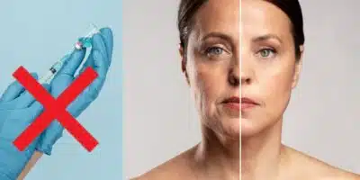 Receitinha mais forte que botox para dar fim às rugas (Foto: Reprodução/ Internet)