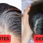 Antes e depois dos cabelos grisalhos surgirem (Foto: Reprodução/ Internet)