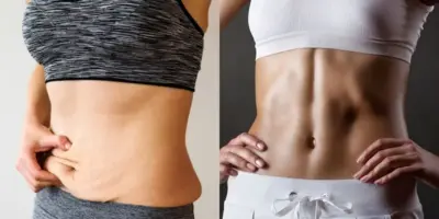 Fim da flacidez na barriga: Receita milagrosa com 4 ingredientes rejuvenesce sua pele em poucos dias