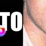 Brasil sofreu luto de estrela da Globo que escondeu diagnóstico até o fim (Foto: Internet)