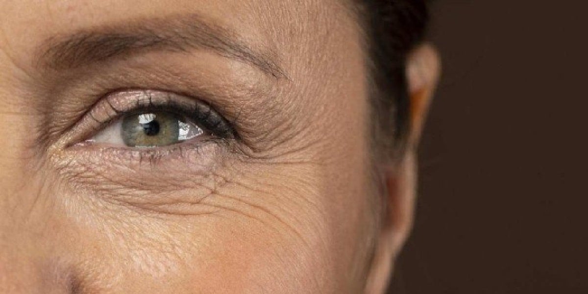 Rugas (Foto: Reprodução/ Internet)