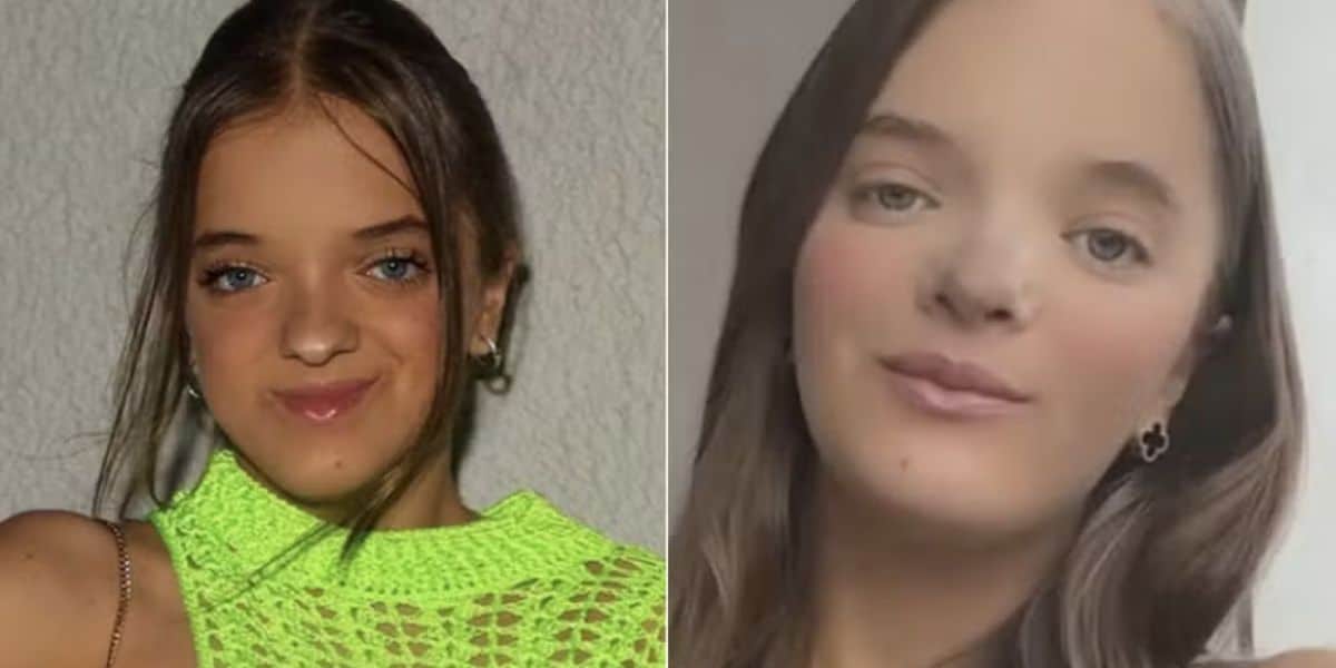 Antes e depois de cirurgia de Rafinha Justus (Foto: Reprodução / Instagram / Motagem)