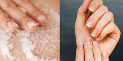Adeus manchas nas mãos e unhas inquebravéis: Melhor esfoliante do mundo é 100% caseiro e leva só 3 produtos