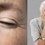 Mulher com e sem rugas (Fotos: Reproduções / Freepik/ Montagem)