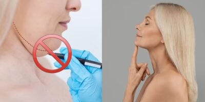 Mulher com papada e realizando pré cirurgia plástica e mulher tocando o pescoço (Fotos: Reproduções / Freepik)