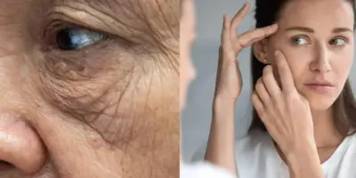 Suga rugas e estica pele por menos de R$ 50: Harmonização caseira traz pele de porcelana em 1 hora