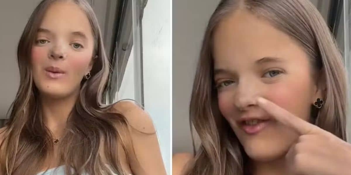Rinoplastia Rafinha Justus (Foto: Reprodução / TikTok)