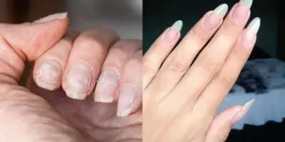 Inquebráveis, gigantes e manicures escondem: Misturinha com 2 ingredientes salva as unhas em 10 minutos