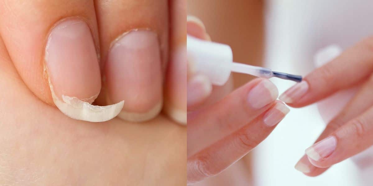 Unhas quebradas / Unhas fortes - Montagem TVFOCO