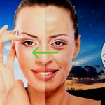 Botox Caseiro elimina manchas e rugas da noite para o dia (Foto Reprodução/Montagem/Lennita/Tv Foco/Canva)