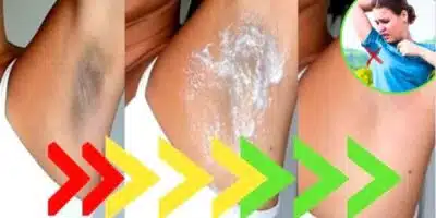 Imagem PreCarregada