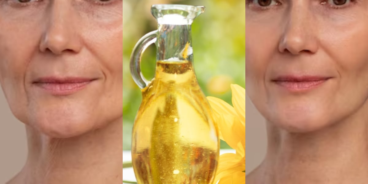 Tratamento com óleos acabam com rugas (Foto: Divulgação)