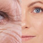 Ingrediente melhor que o colágeno dá adeus as rugas e rejuvenesce 40 anos (Reprodução: Montagem TV Foco)