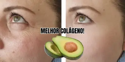 Rugas eliminadas: Melhor colágeno do mundo com abacate + 2 ingredientes deixa pele de senhoras 60+ lisinha