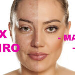 Botox caseiro - Rugas e Manchas (Foto: Reprodução - Drogaria Vera Cruz)