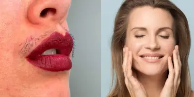 Fim do bigode sem dor: Misturinha com 2 ingredientes acaba com os pelos do buço em apenas 15 minutos
