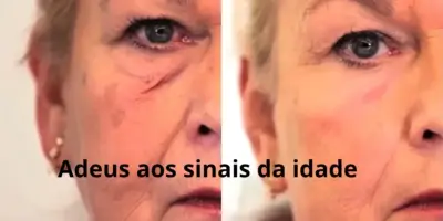 Colágeno eterno: 4 segredos milagrosos sugam qualquer sinal de idade e dão fim aos problemas de saúde das 60+